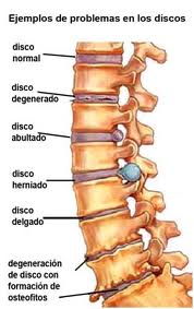 Columna Vertebral