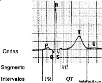 miocardio