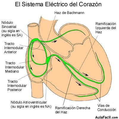 miocardio