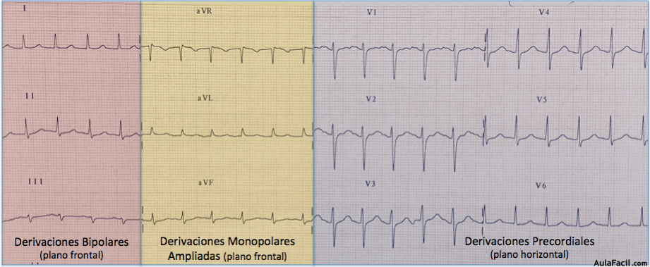 ECG en derivaciones