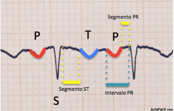 Imagen 31. Segmento e intervalo