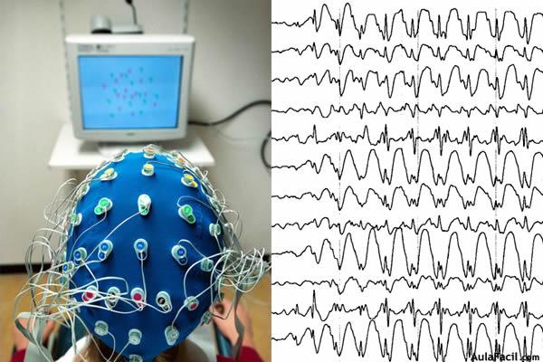 Electroencefalograma