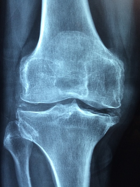 knee 1406964 640